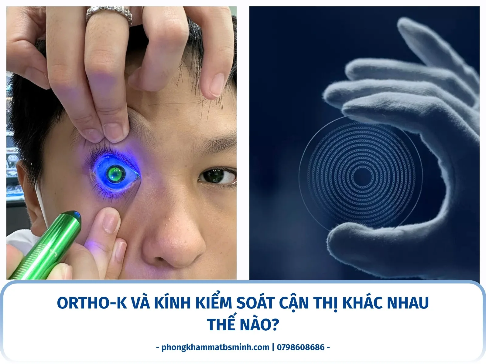 Ortho-K và kính kiểm soát cận thị khác nhau thế nào?
