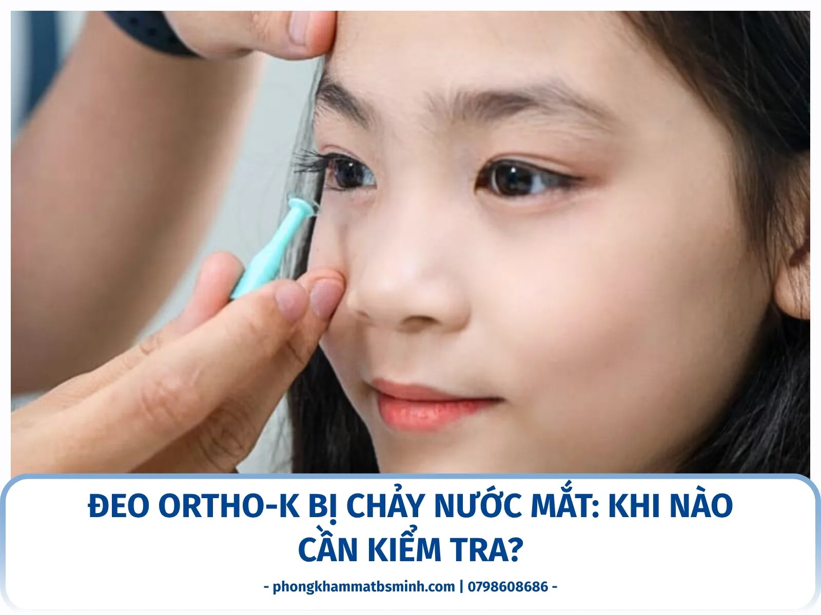 Đeo Ortho-K bị chảy nước mắt: khi nào cần kiểm tra?