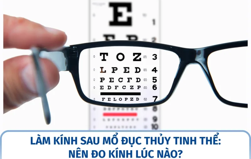 Làm kính sau mổ đục thủy tinh thể: nên đo kính lúc nào?