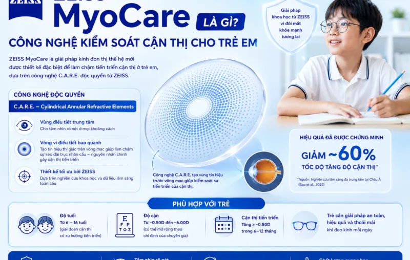 ZEISS MyoCare là gì? Công nghệ kiểm soát cận thị cho trẻ em