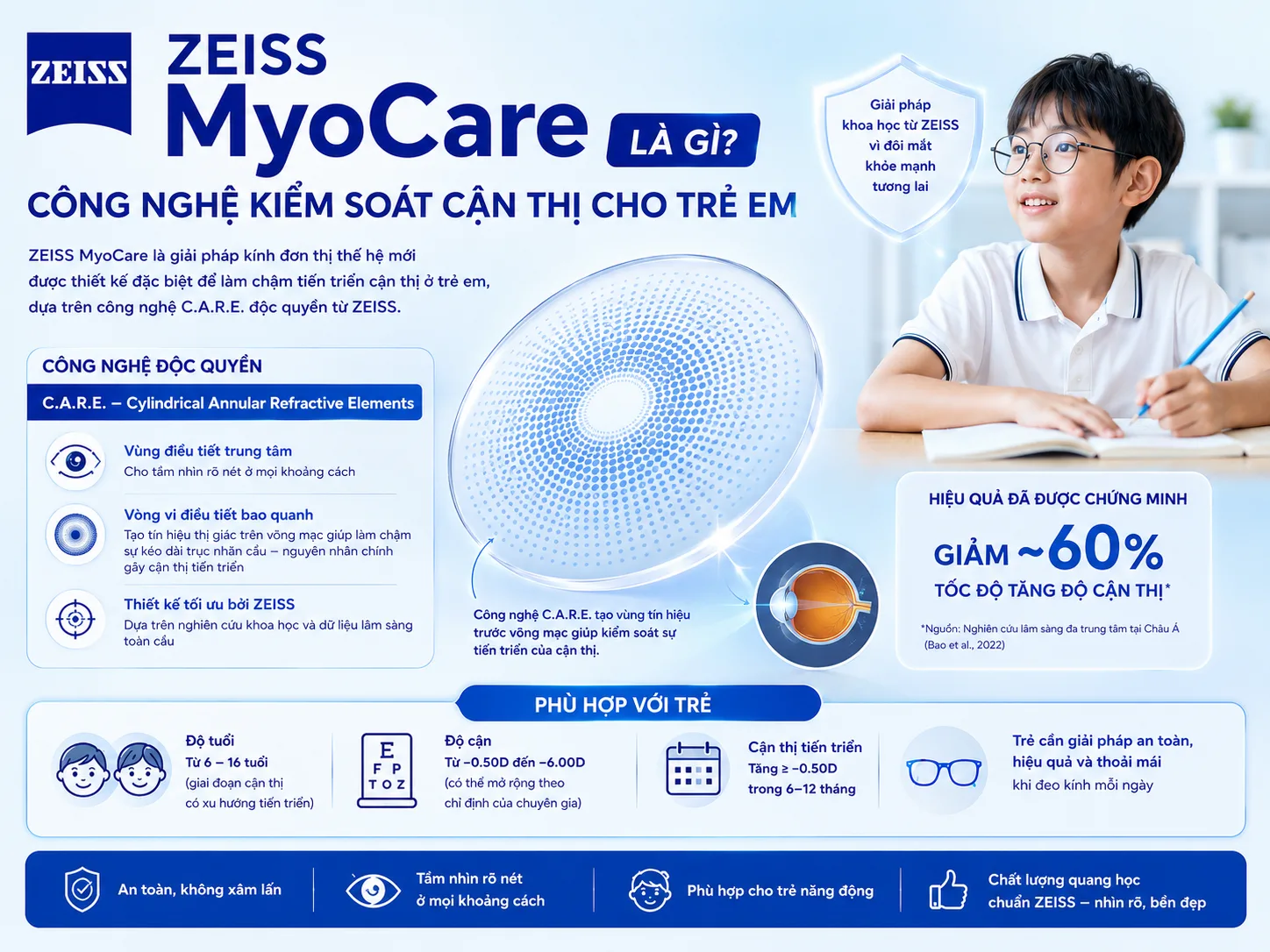 ZEISS MyoCare là gì? Công nghệ kiểm soát cận thị cho trẻ em