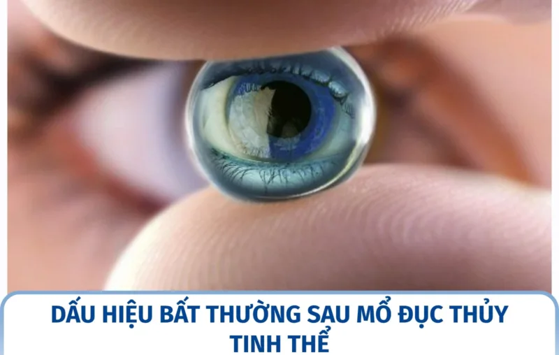 Dấu hiệu bất thường sau mổ đục thủy tinh thể