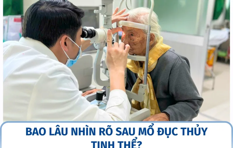 Bao lâu nhìn rõ sau mổ đục thủy tinh thể?