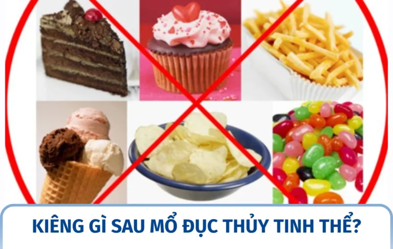 Kiêng gì sau mổ đục thủy tinh thể?