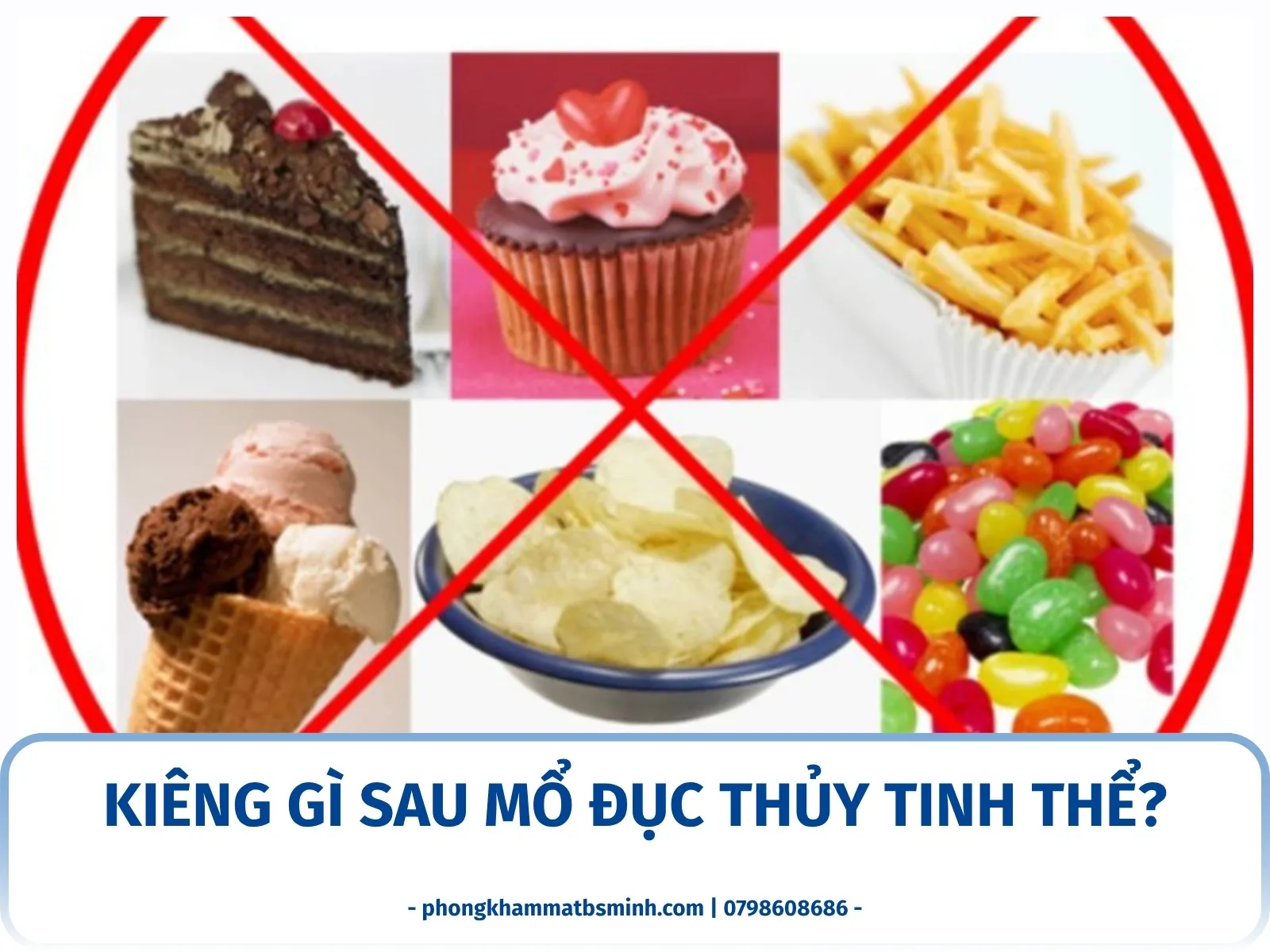 Kiêng gì sau mổ đục thủy tinh thể?