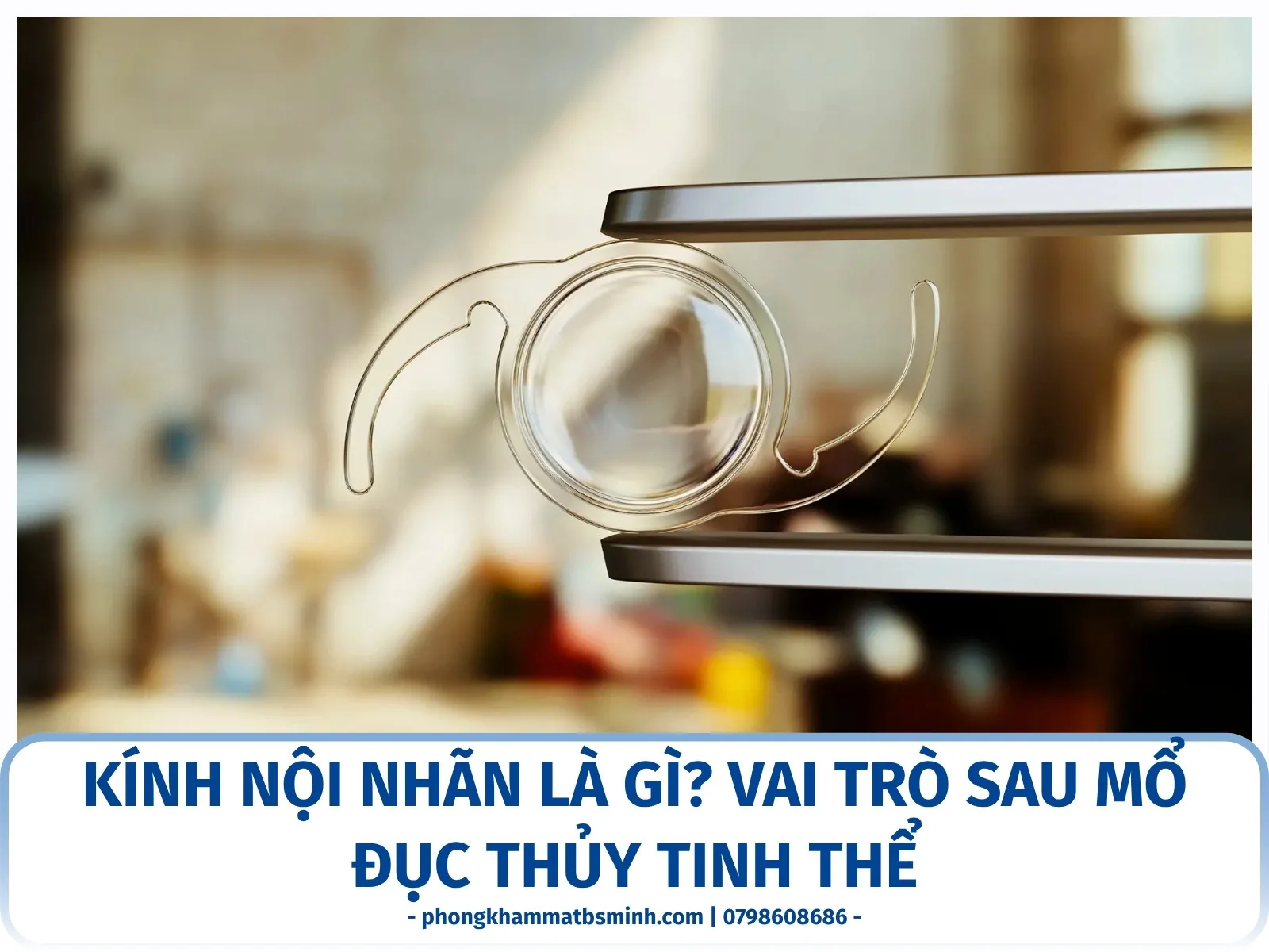 Kính nội nhãn là gì? Vai trò sau mổ đục thủy tinh thể