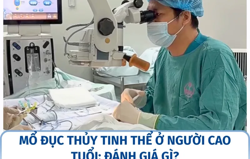Mổ đục thủy tinh thể ở người cao tuổi: đánh giá gì?
