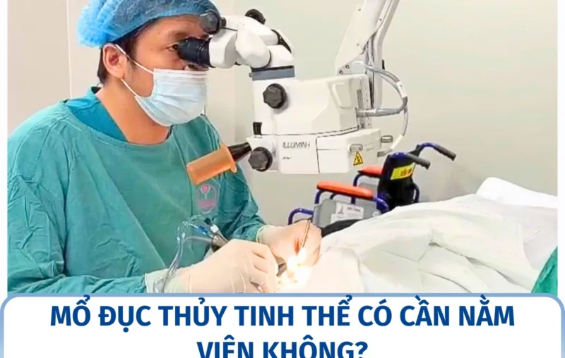 Mổ đục thủy tinh thể có cần nằm viện không?