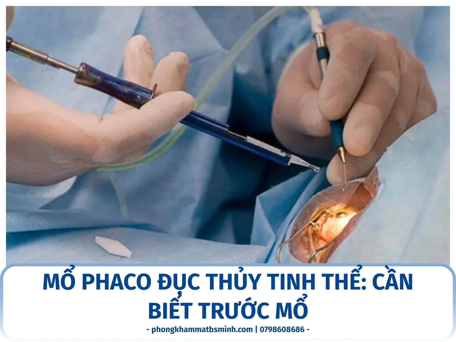 Mổ phaco đục thủy tinh thể: cần biết trước mổ