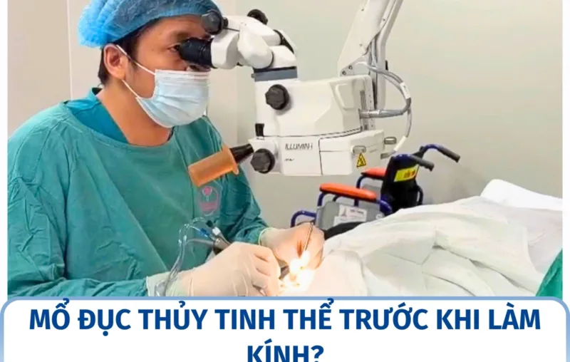Mổ đục thủy tinh thể trước khi làm kính?