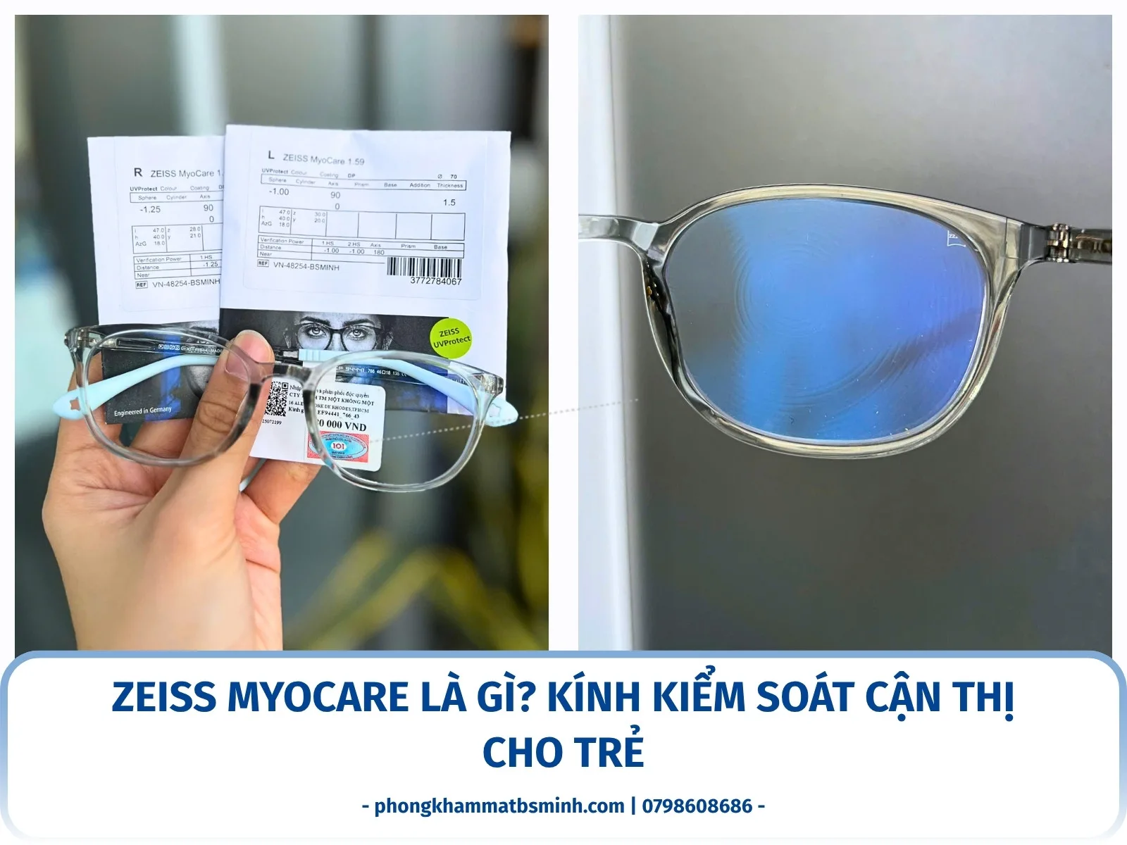 ZEISS MyoCare là gì? Kính kiểm soát cận thị cho trẻ