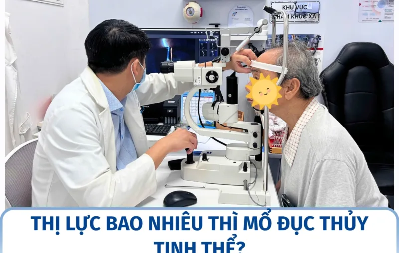 Thị lực bao nhiêu thì mổ đục thủy tinh thể?