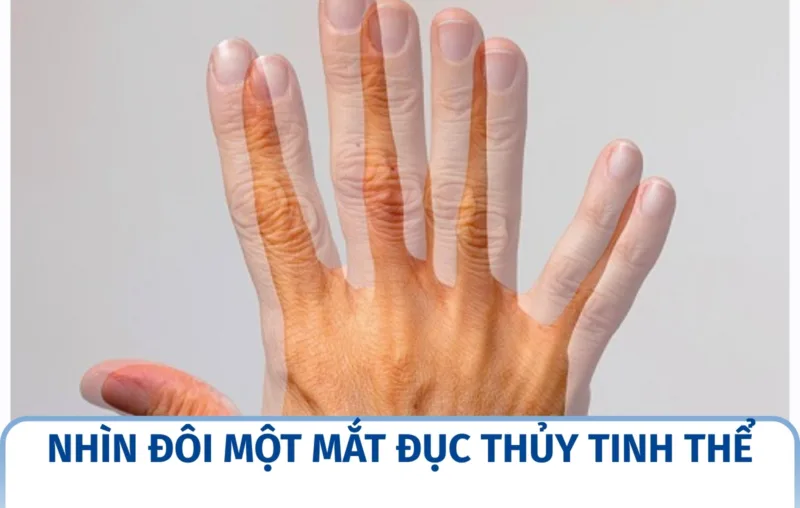 Nhìn đôi một mắt đục thủy tinh thể