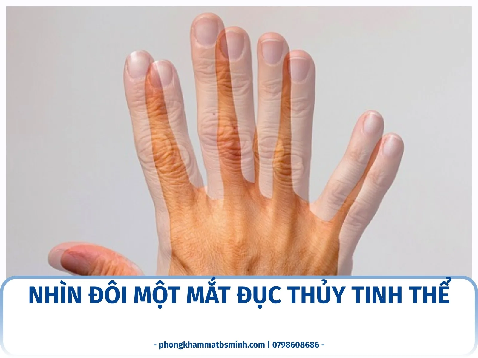 Nhìn đôi một mắt đục thủy tinh thể