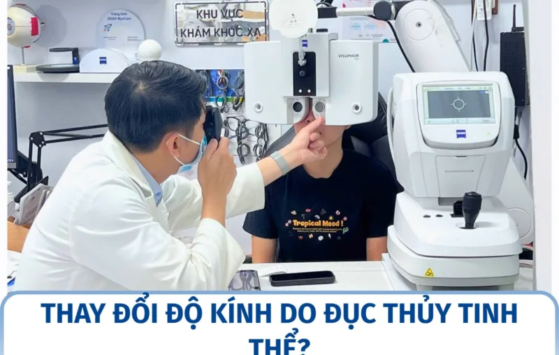 Thay đổi độ kính do đục thủy tinh thể?