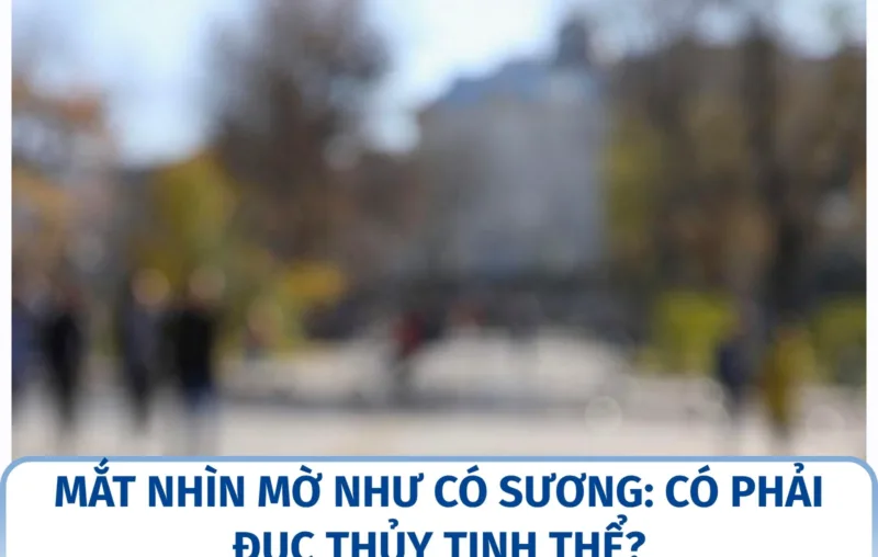 Mắt nhìn mờ như có sương: có phải đục thủy tinh thể?