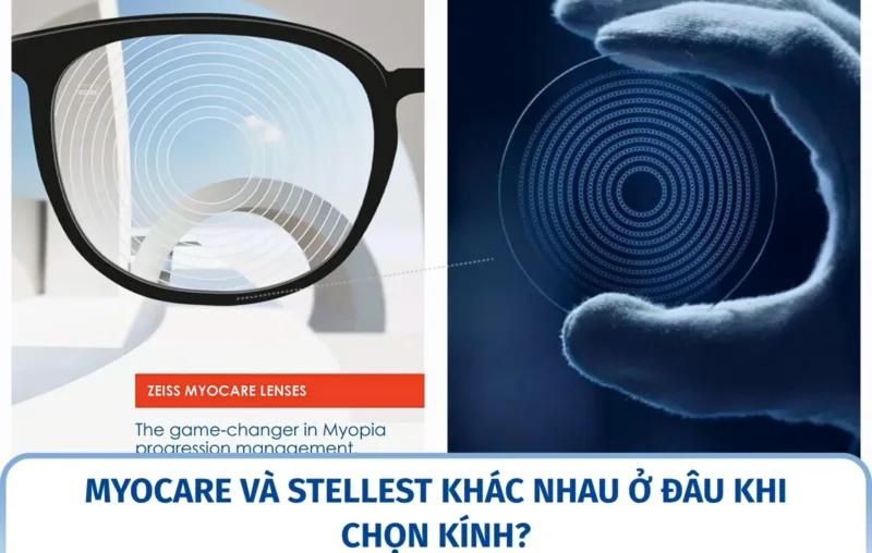 MyoCare và Stellest khác nhau ở đâu khi chọn kính?