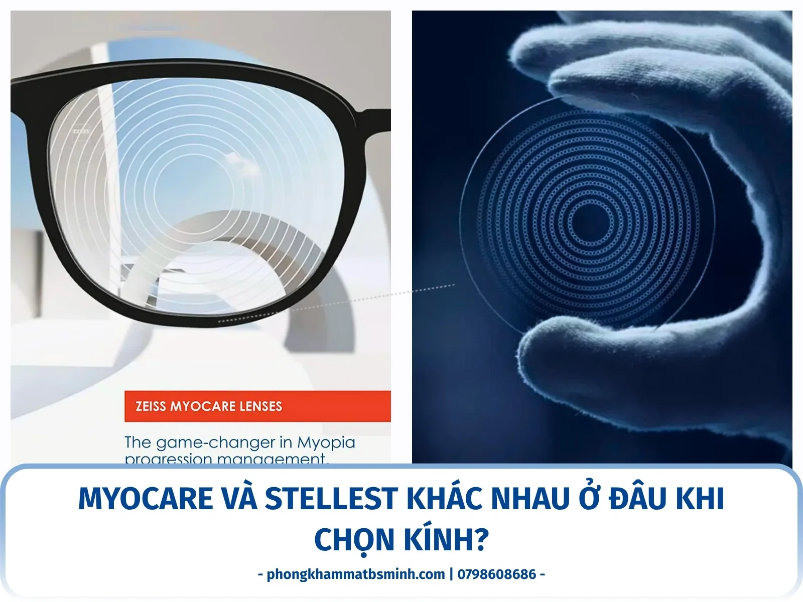 MyoCare và Stellest khác nhau ở đâu khi chọn kính?