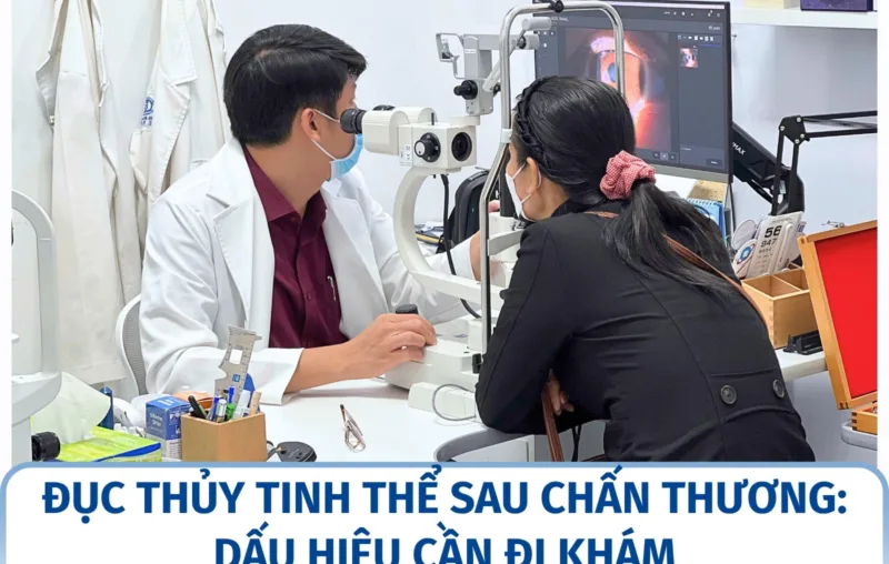 Đục thủy tinh thể sau chấn thương: dấu hiệu cần đi khám
