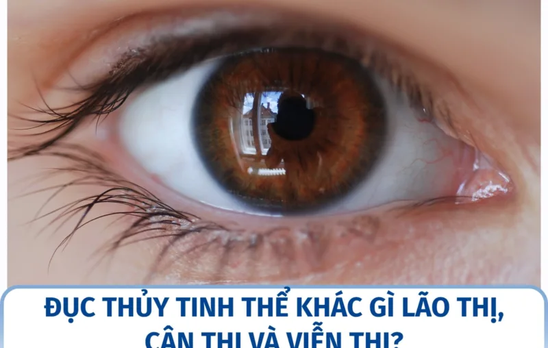 Đục thủy tinh thể khác gì lão thị, cận thị và viễn thị?