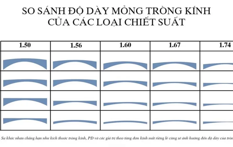 Độ cận bao nhiêu nên dùng tròng 1.67?