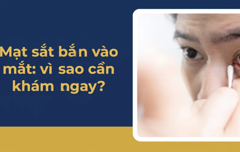 Mạt sắt bắn vào mắt: vì sao cần khám ngay