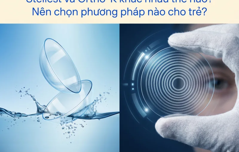 stellest-va-ortho-k-khac-nhau-the-nao