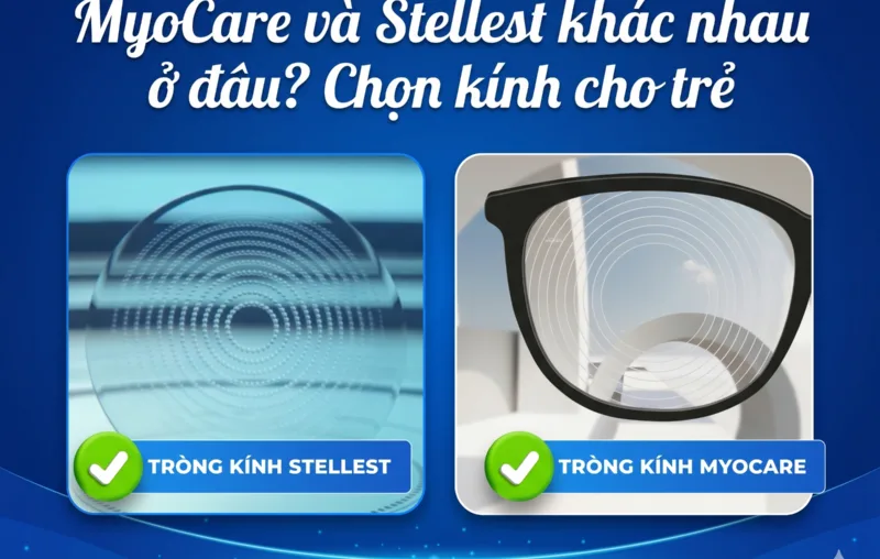 myocare va stellest khac nhau o dau