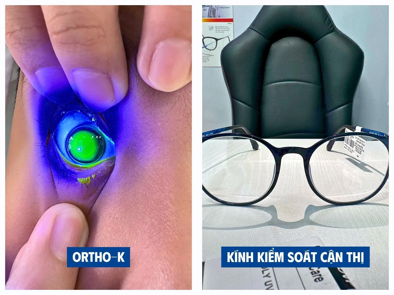 Trẻ không hợp tác đeo Ortho-K có thể chọn kính kiểm soát cận thị không?