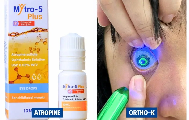 Phối hợp Ortho-K và Atropine: trường hợp nào cần cân nhắc?