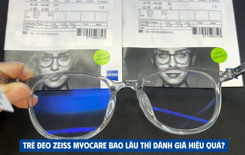 Trẻ đeo ZEISS MyoCare bao lâu thì đánh giá hiệu quả?