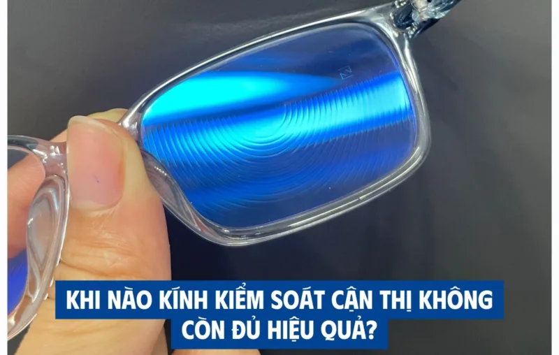 Khi nào kính kiểm soát cận thị không còn đủ hiệu quả?