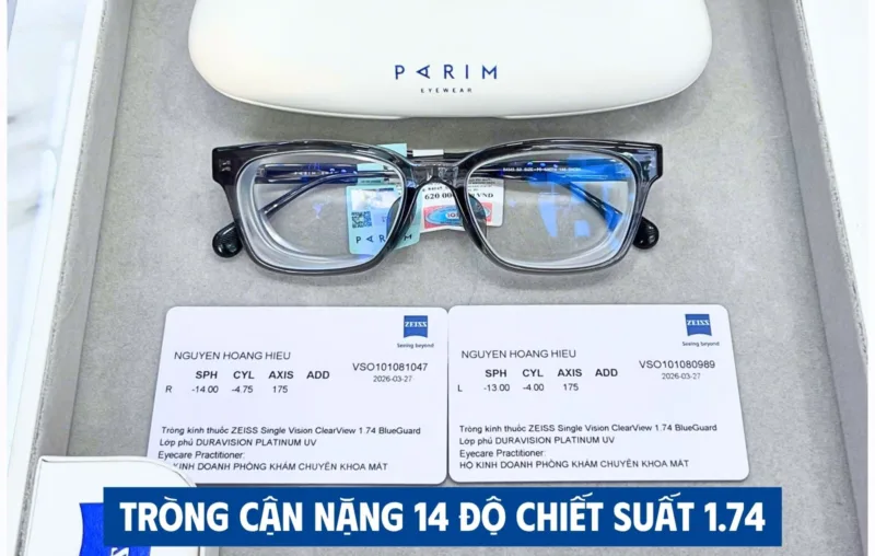 Cận nặng nên chọn tròng chiết suất bao nhiêu?