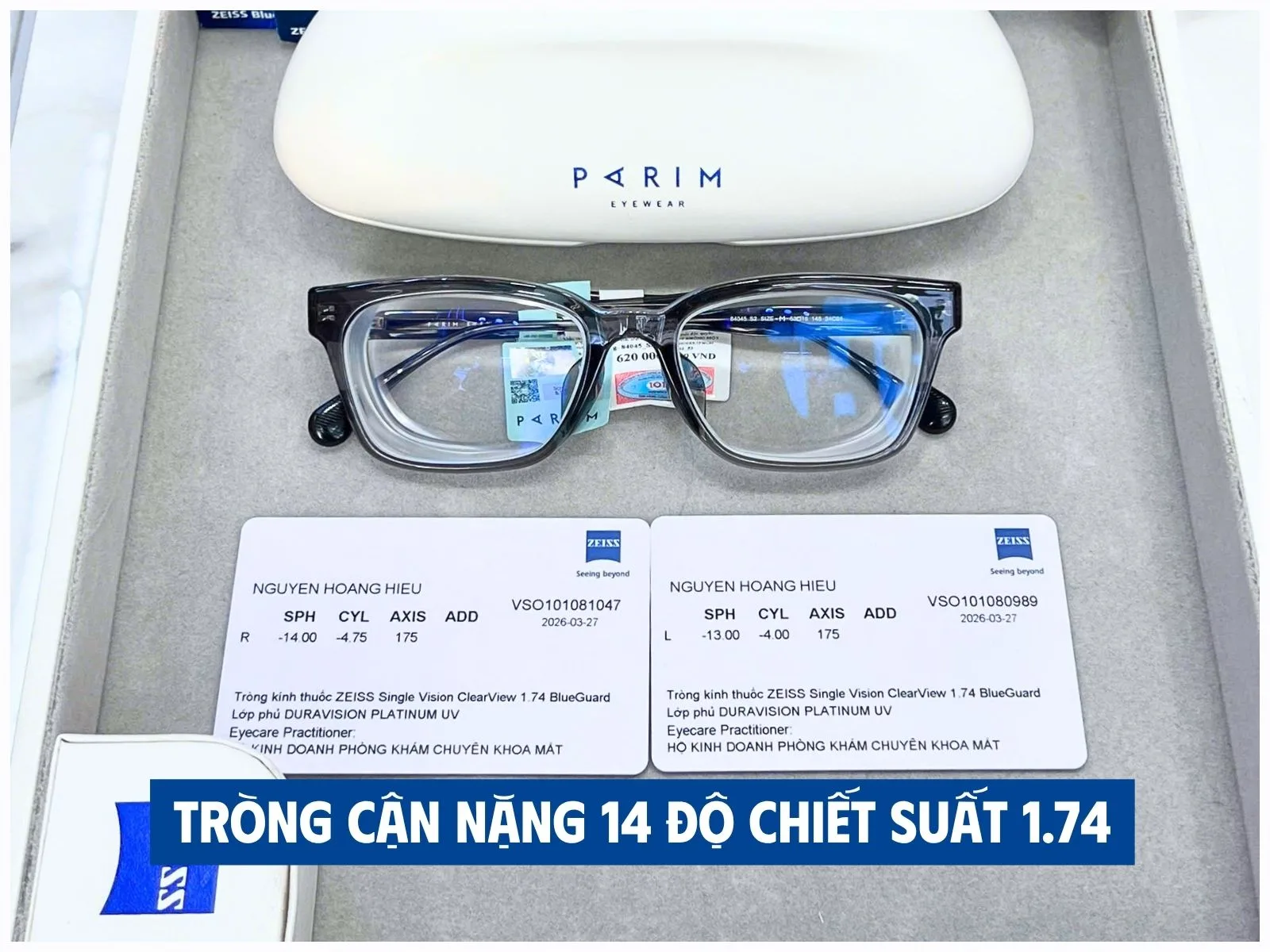 Cận nặng nên chọn tròng chiết suất bao nhiêu?