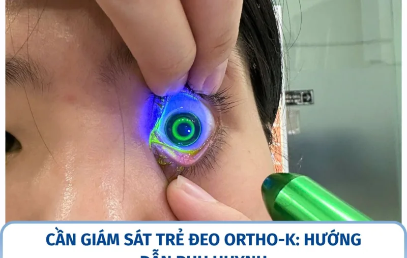 Cần giám sát trẻ đeo Ortho-K: hướng dẫn phụ huynh