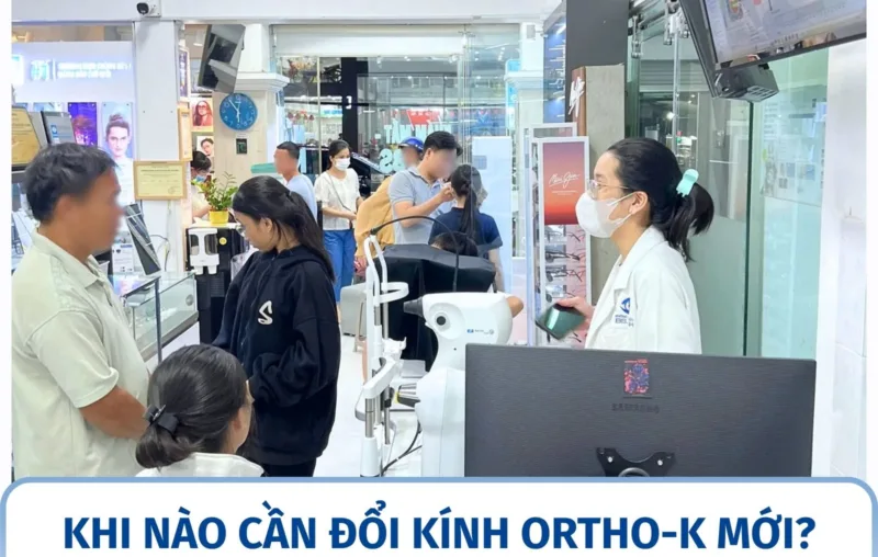 Khi nào cần đổi kính Ortho-K mới?