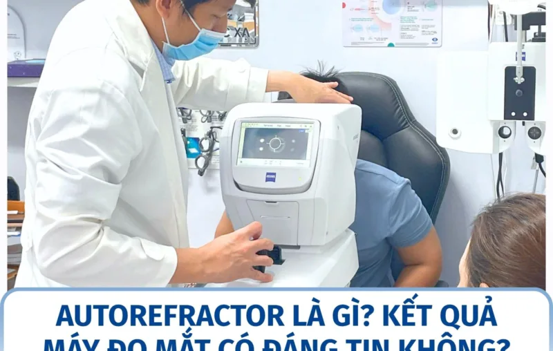 Autorefractor là gì? Kết quả máy đo mắt có đáng tin không?