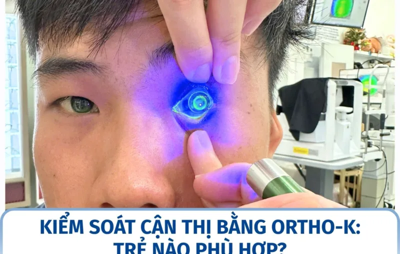 Kiểm soát cận thị bằng Ortho-K: trẻ nào phù hợp?