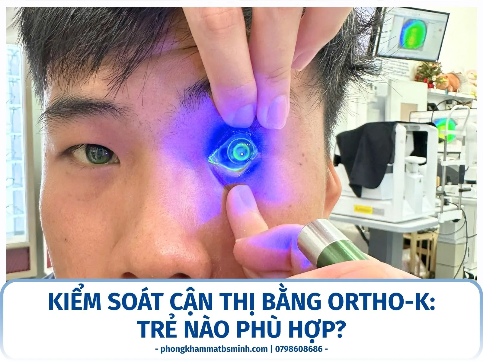 Kiểm soát cận thị bằng Ortho-K: trẻ nào phù hợp?