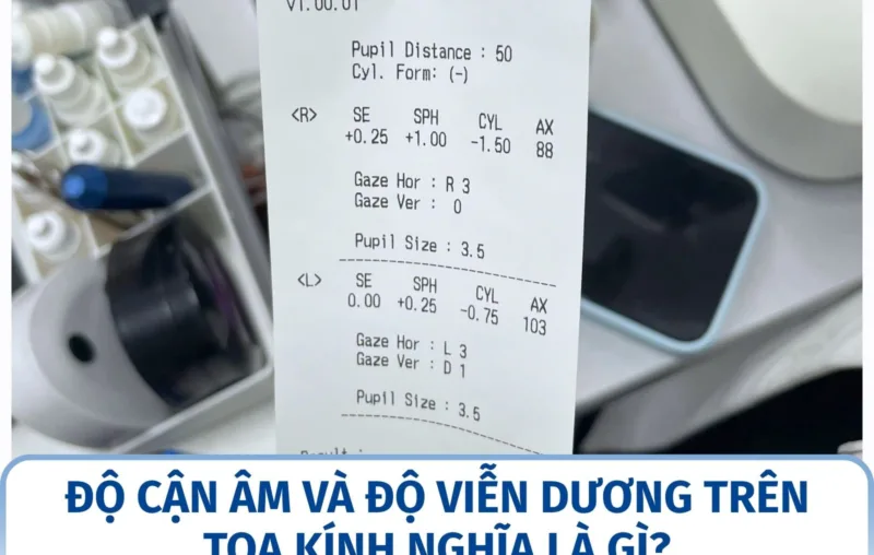 Độ cận âm và độ viễn dương trên toa kính nghĩa là gì?