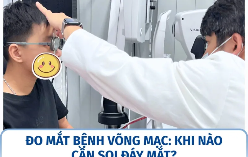 Đo mắt bệnh võng mạc: khi nào cần soi đáy mắt?