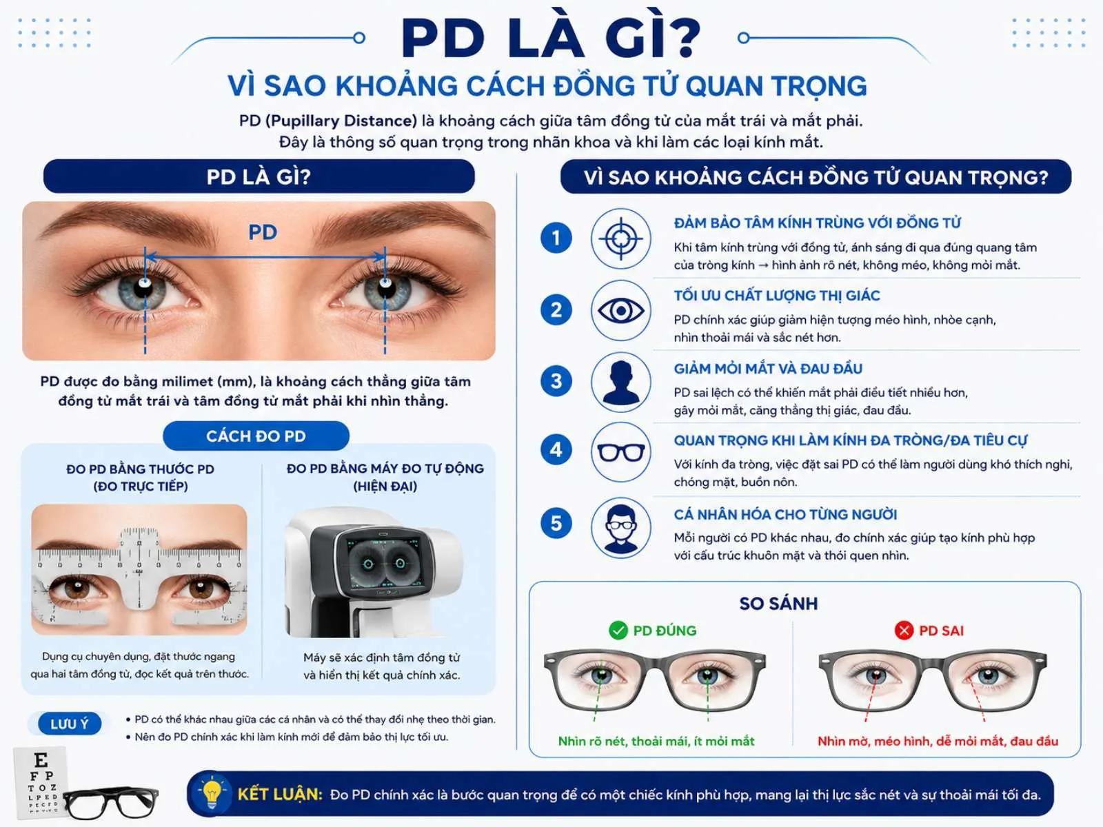 PD là gì? Vì sao khoảng cách đồng tử quan trọng