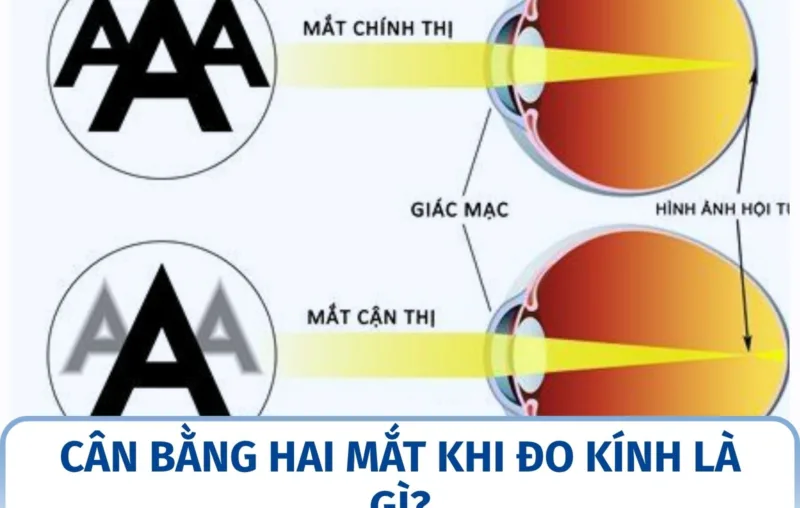 Cân bằng hai mắt khi đo kính là gì?