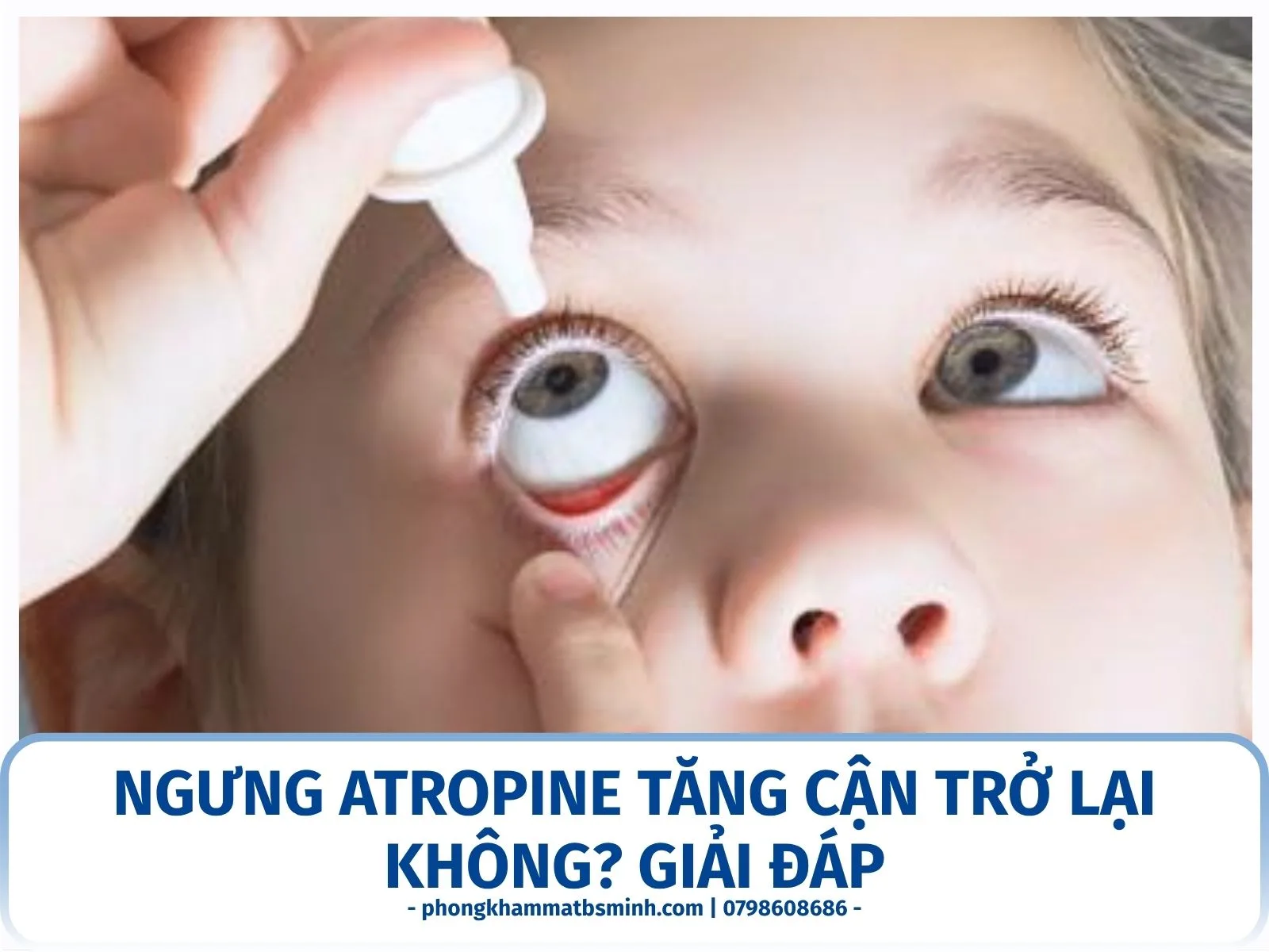 Ngưng Atropine tăng cận trở lại không? Giải đáp