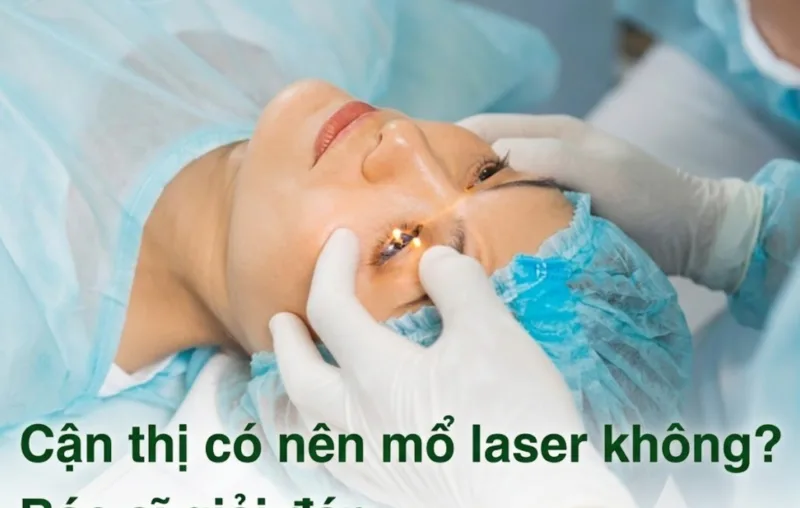 Cận thị có nên mổ laser không