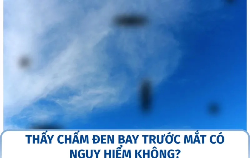 Thấy chấm đen bay trước mắt có nguy hiểm không?