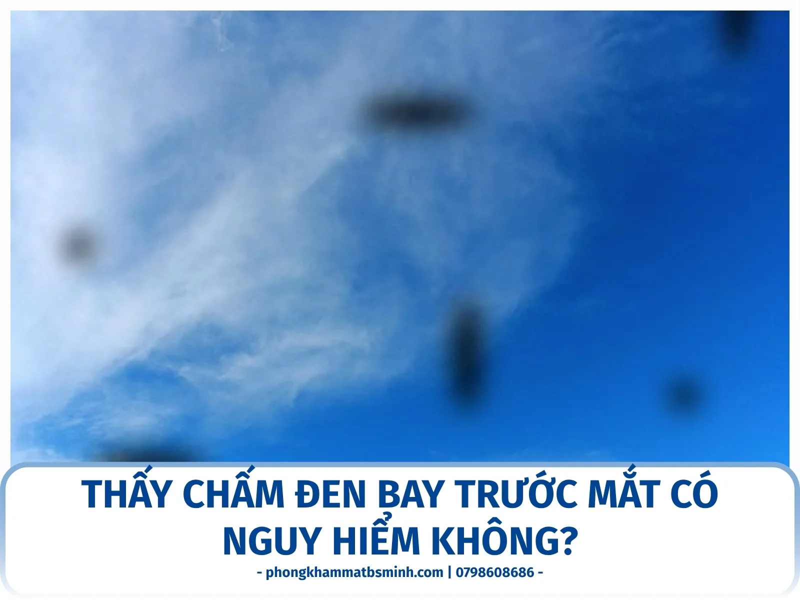 Thấy chấm đen bay trước mắt có nguy hiểm không?