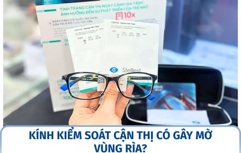 Kính kiểm soát cận thị có gây mờ vùng rìa?