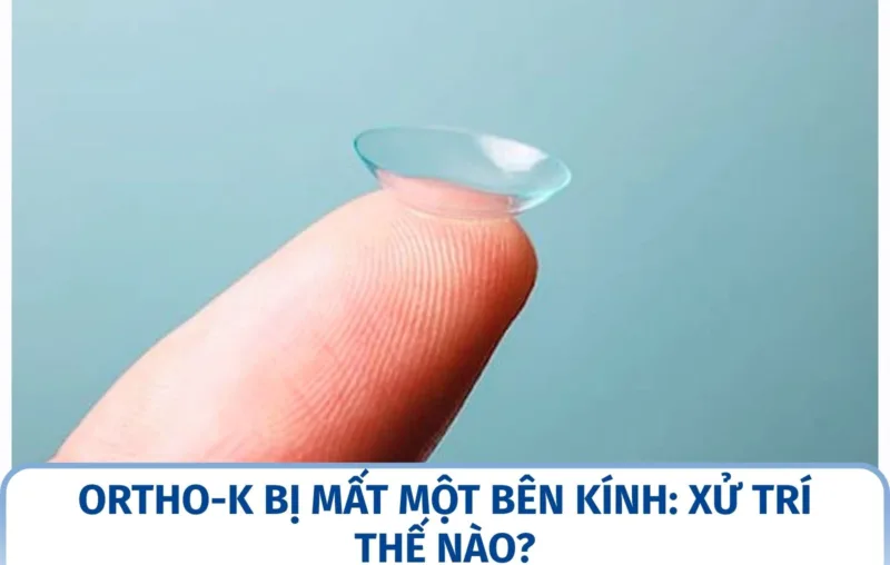 Ortho-K bị mất một bên kính: xử trí thế nào?