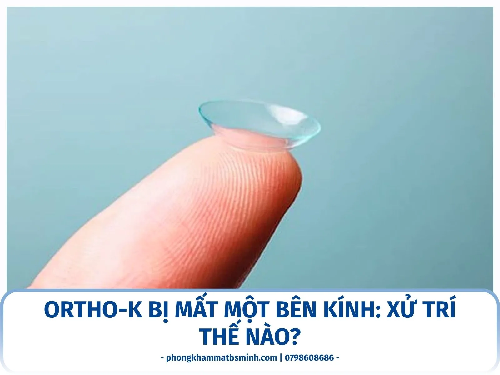 Ortho-K bị mất một bên kính: xử trí thế nào?